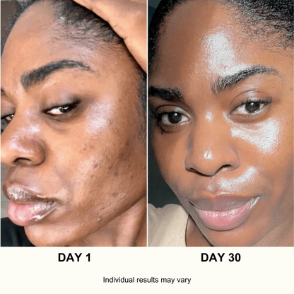 ANUA Ultimate Korean Skincare Set