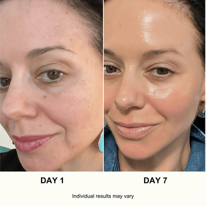 ANUA Ultimate Korean Skincare Set